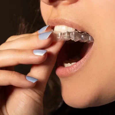 Що пішло не так у Smile Direct Club?