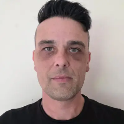 I’m a carer but I can’t afford to go to work because of fuel prices